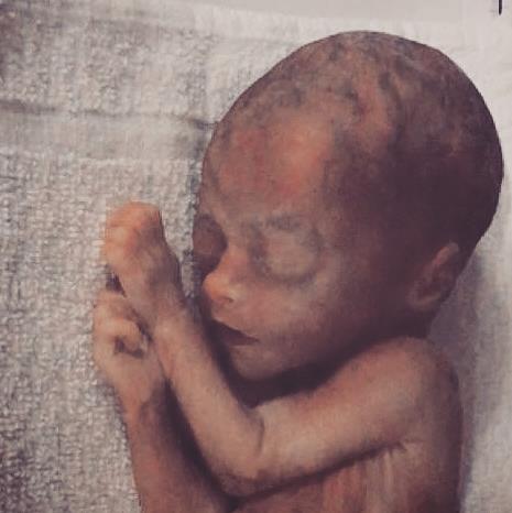 Freya Belle Rose Obituary