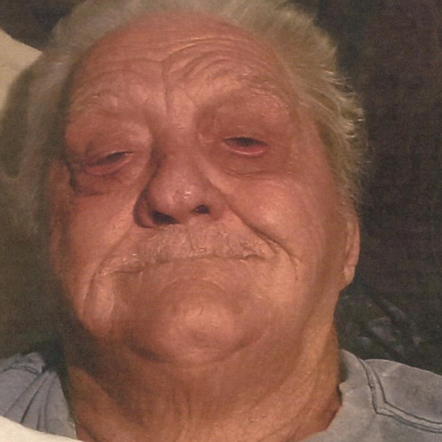 Elkins Ac Obituary